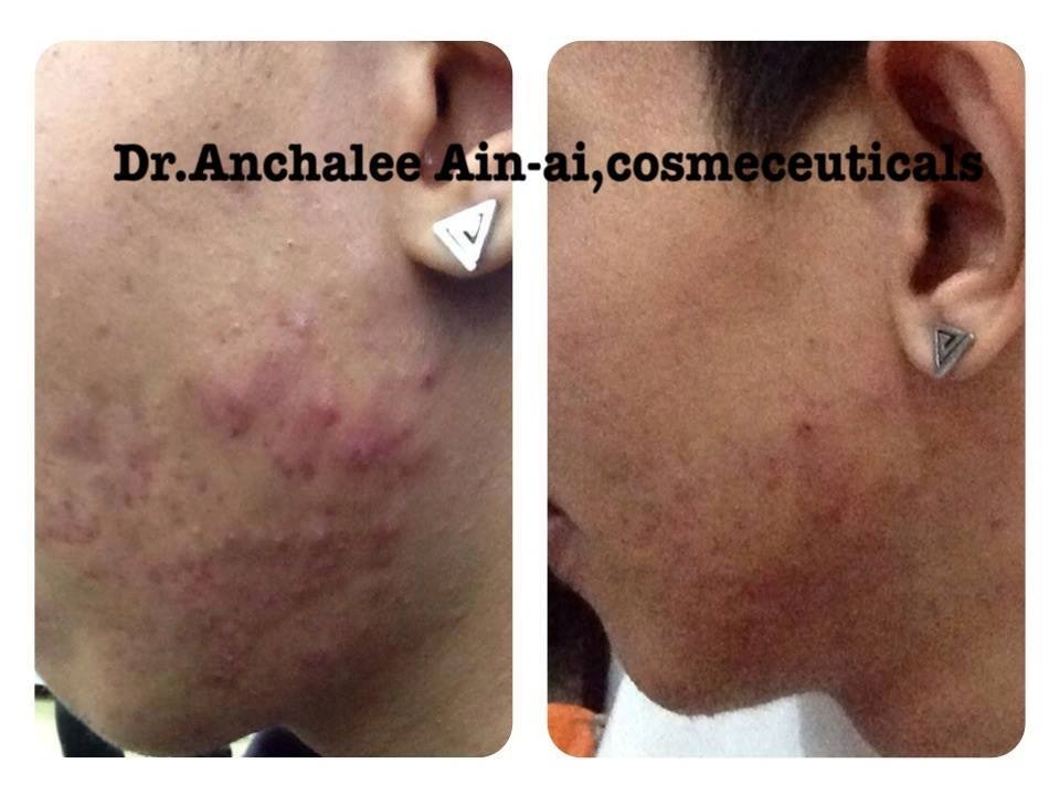 Customer Review - Dr. Anchalee Ain ai, Cosmeceuticals USA – เวชสำอางจากธรรมชาติ